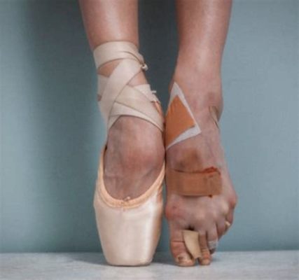 Is Ballet Bad for Your Feet: A Comprehensive Viewpoint on the Impact of Ballet Training on the Dancers' Feet